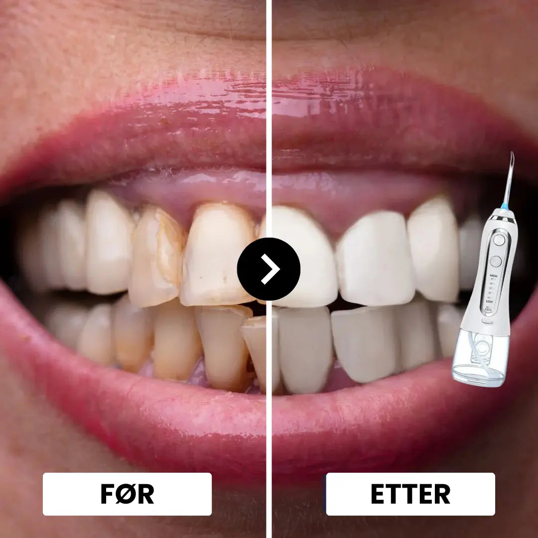 VivaFloss vannflosser resultater